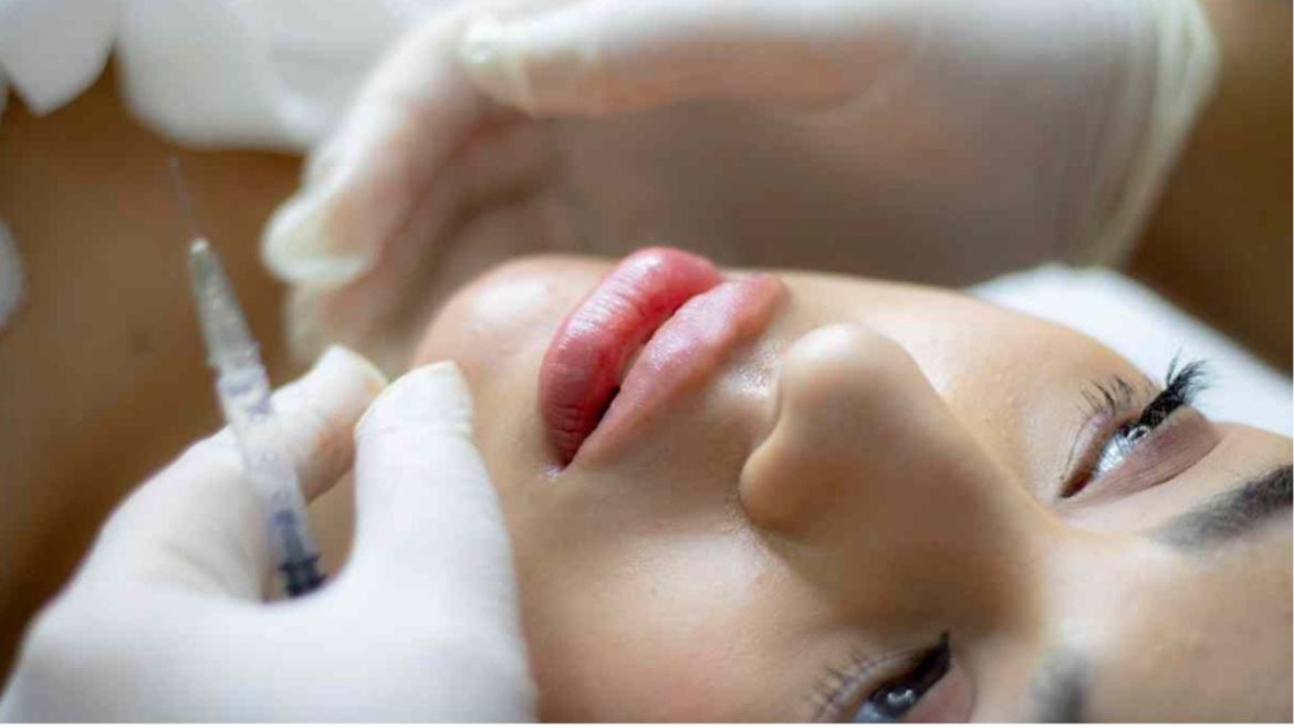 Filler viso, il trattamento più amato e richiesto ecco perché (1)