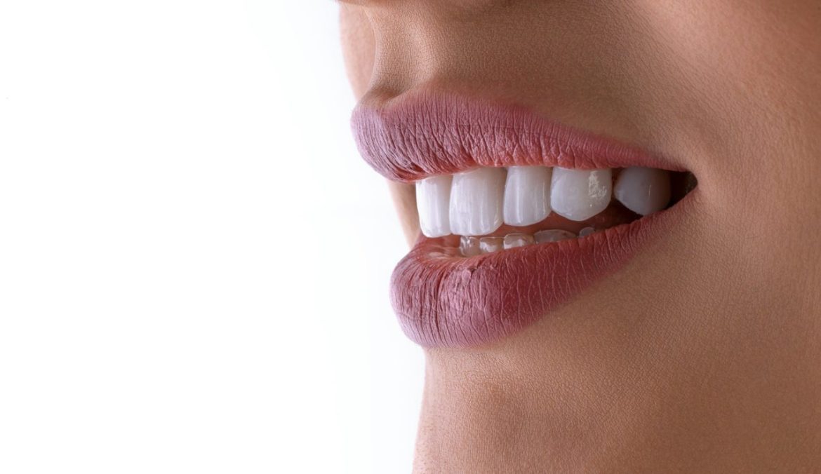 Perché la prevenzione è il primo passo per un sorriso sano