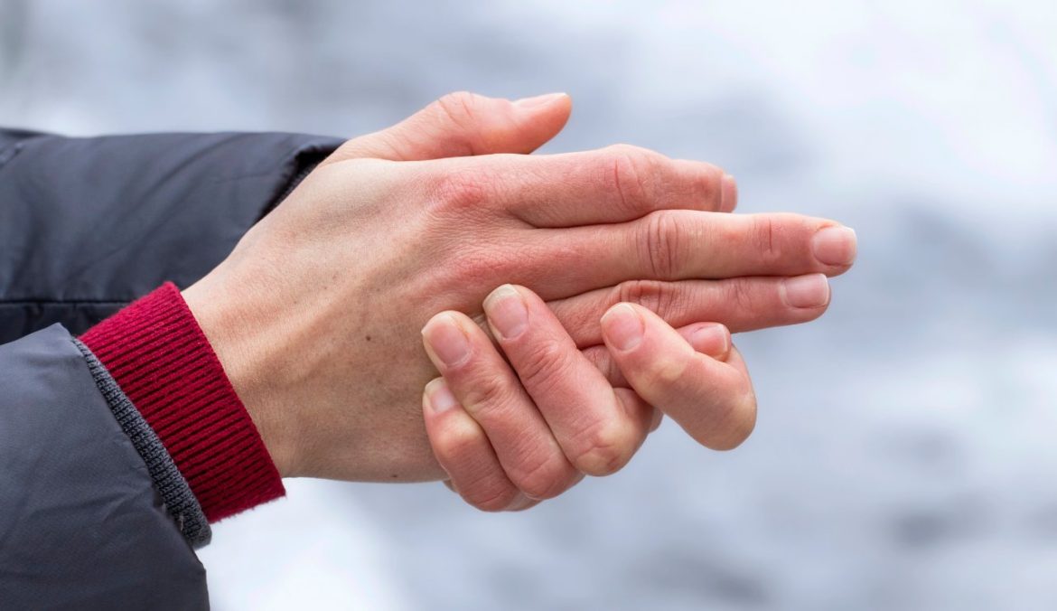 Rimedi ragadi alle mani e dita in inverno perché vengono, come curarle in modo naturale e prevenirl